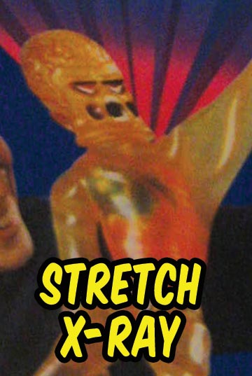 kenner stretch X Ray